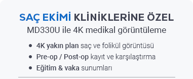 Saç ekimi bilgilendirme